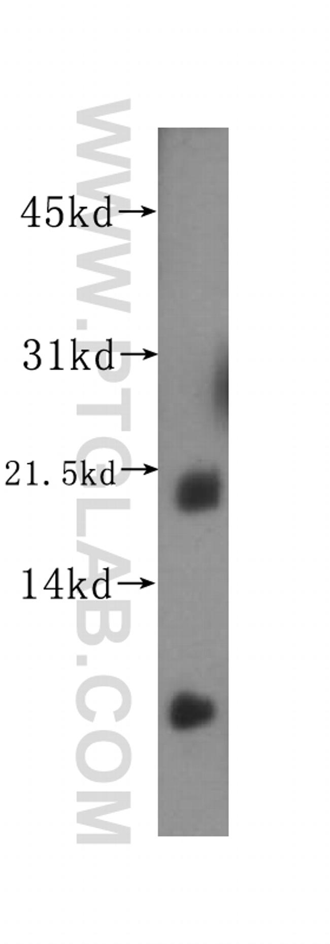 SAT2 Antibody in Western Blot (WB)