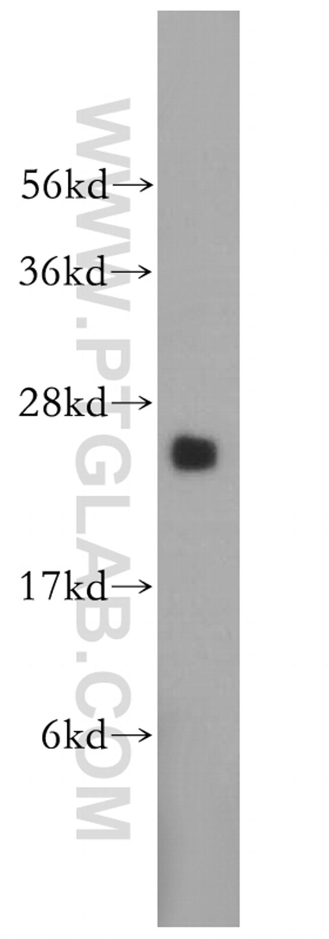 PSF2 Antibody in Western Blot (WB)