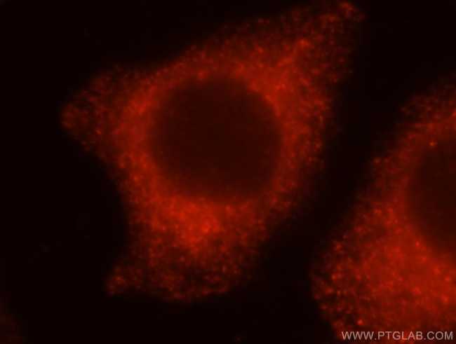 PRKCDBP Antibody in Immunocytochemistry (ICC/IF)