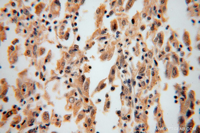 PRKCDBP Antibody in Immunohistochemistry (Paraffin) (IHC (P))