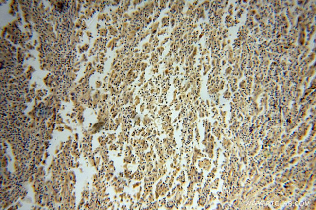 PRKCDBP Antibody in Immunohistochemistry (Paraffin) (IHC (P))