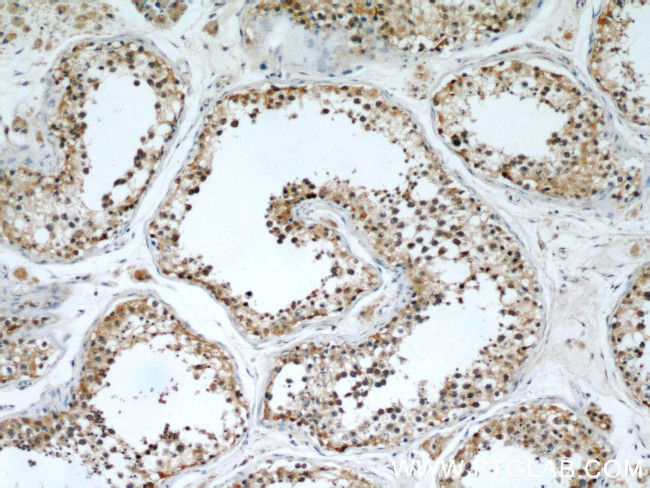 FAF2 Antibody in Immunohistochemistry (Paraffin) (IHC (P))