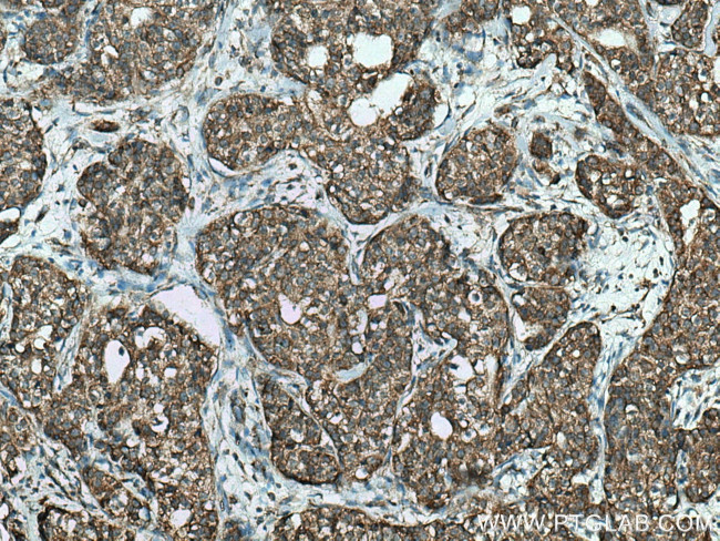 FAF2 Antibody in Immunohistochemistry (Paraffin) (IHC (P))