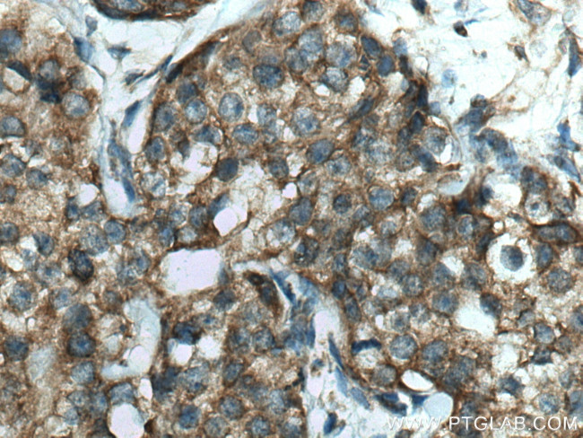 FAF2 Antibody in Immunohistochemistry (Paraffin) (IHC (P))