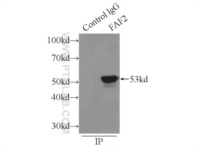 FAF2 Antibody in Immunoprecipitation (IP)