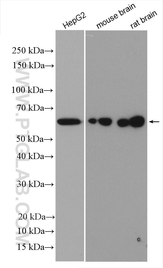 FAF2 Antibody in Western Blot (WB)