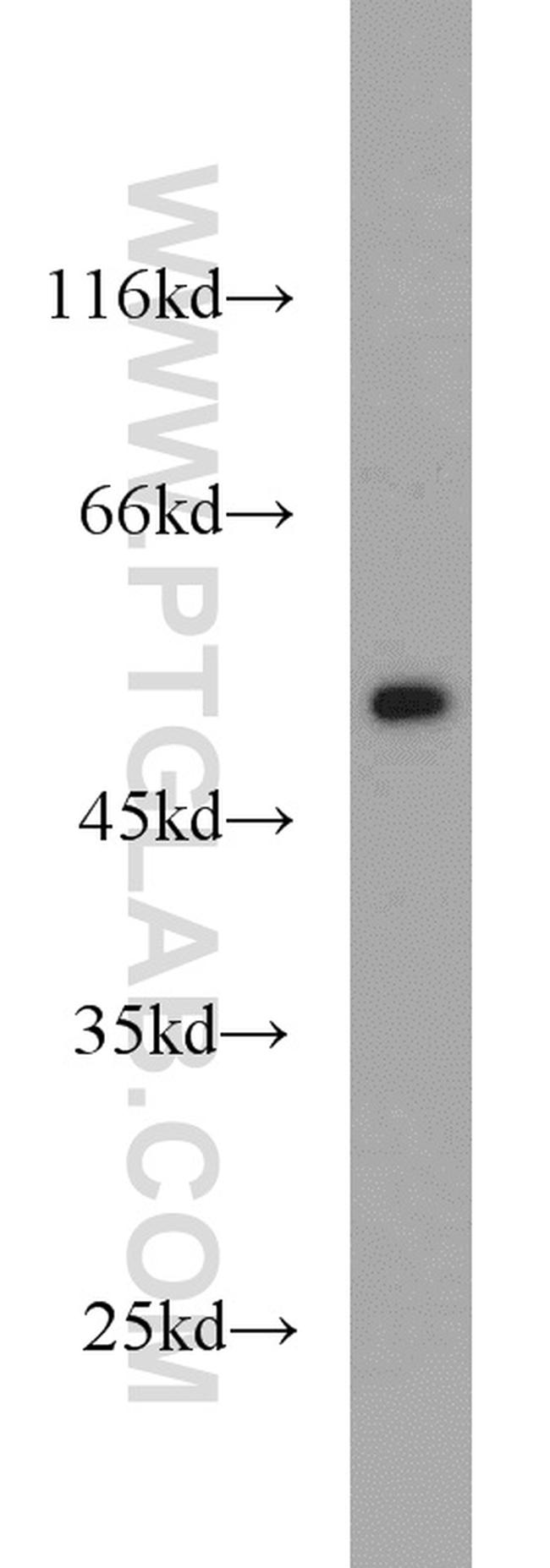 FAF2 Antibody in Western Blot (WB)