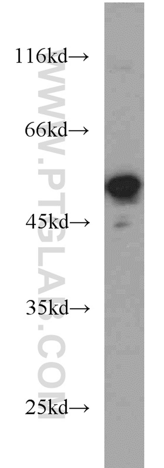 FAF2 Antibody in Western Blot (WB)