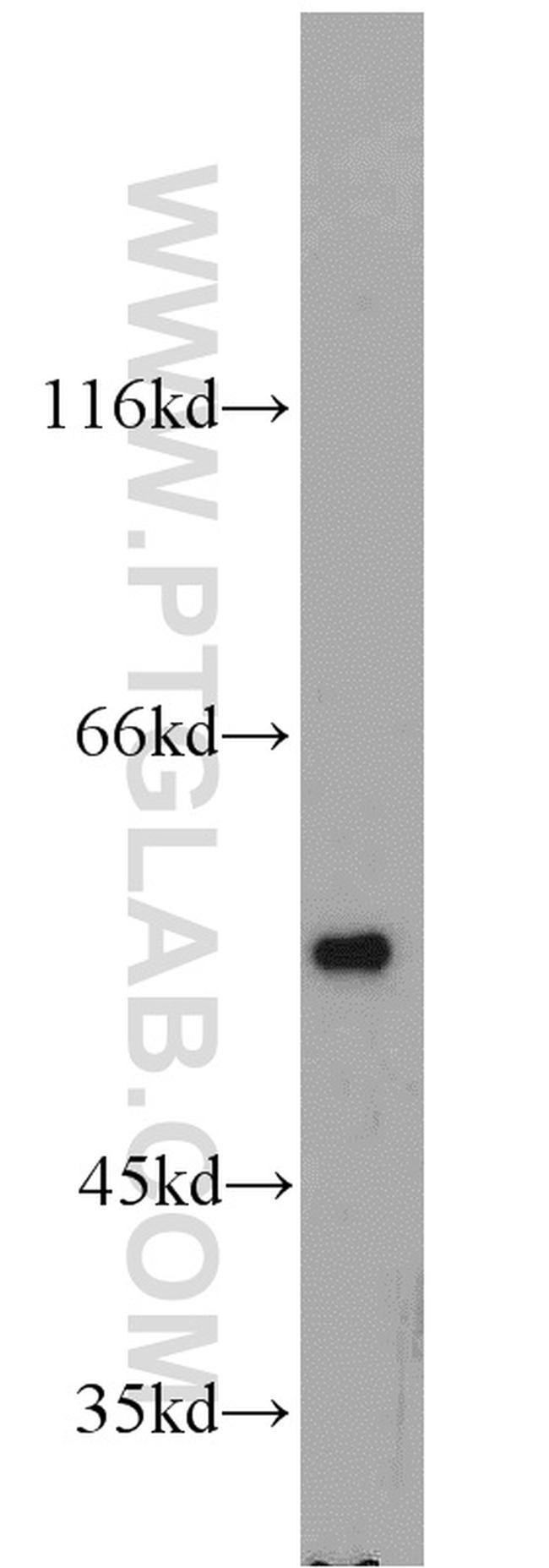 FAF2 Antibody in Western Blot (WB)