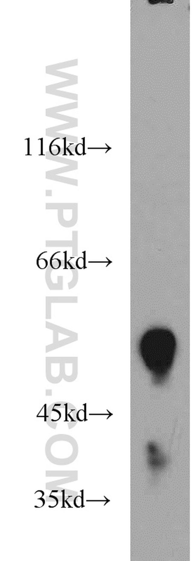 FAF2 Antibody in Western Blot (WB)