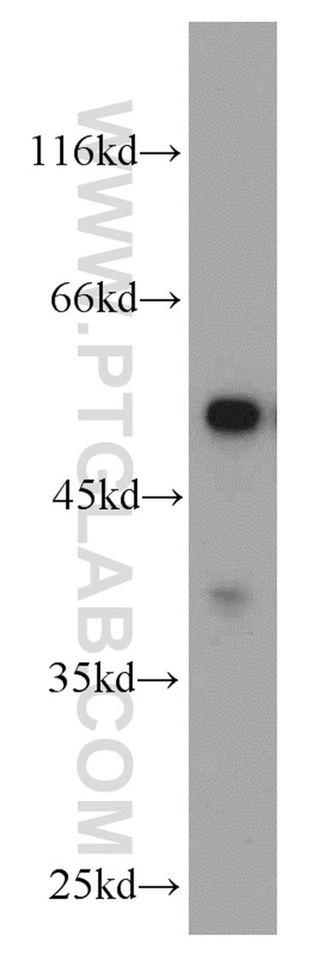 FAF2 Antibody in Western Blot (WB)