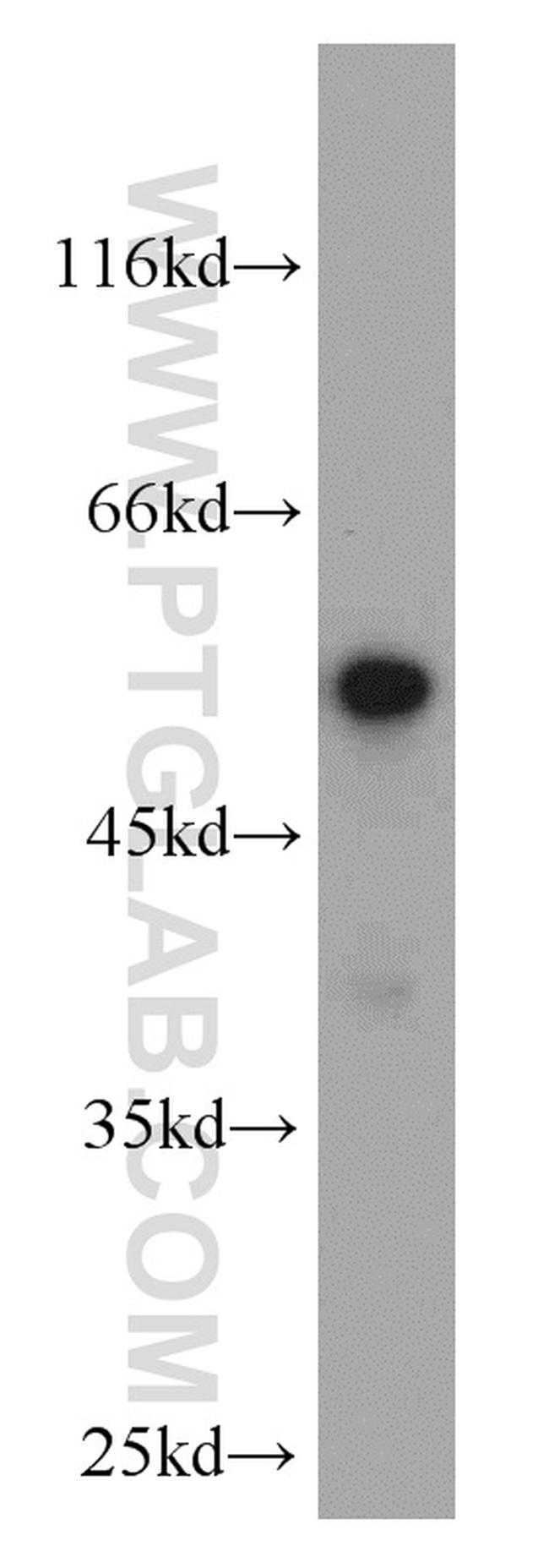 FAF2 Antibody in Western Blot (WB)