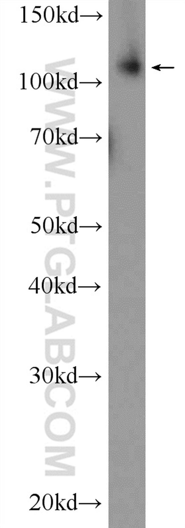 EXO1 Antibody in Western Blot (WB)