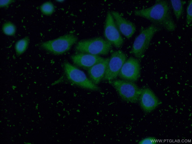 GGCT Antibody in Immunocytochemistry (ICC/IF)