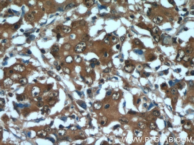 GGCT Antibody in Immunohistochemistry (Paraffin) (IHC (P))