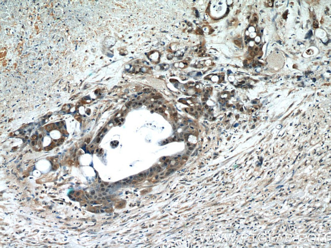 GGCT Antibody in Immunohistochemistry (Paraffin) (IHC (P))