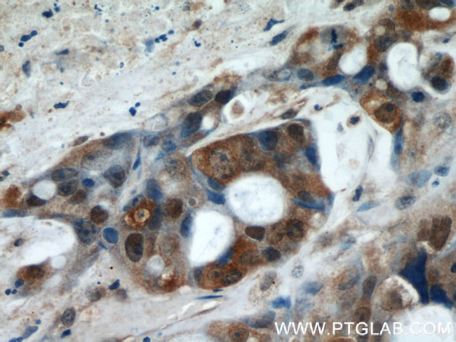 GGCT Antibody in Immunohistochemistry (Paraffin) (IHC (P))