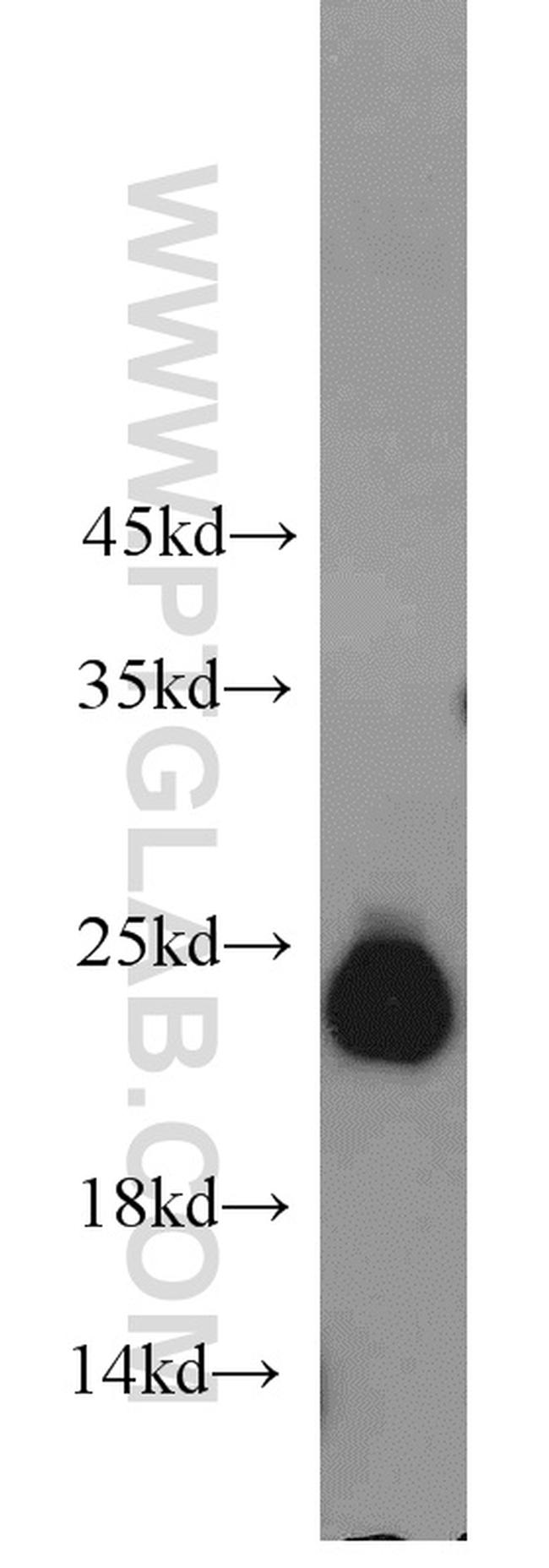 GGCT Antibody in Western Blot (WB)