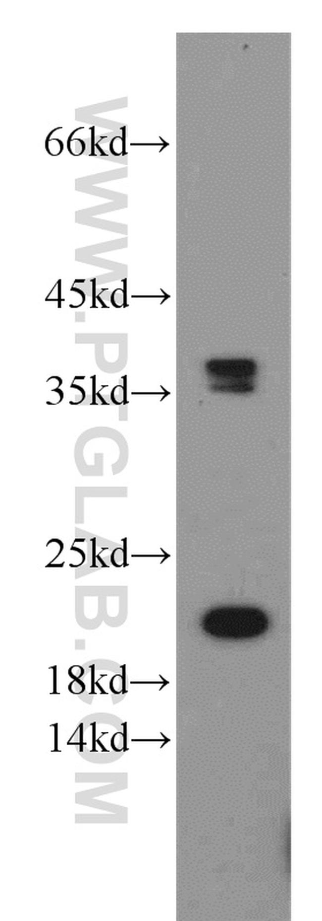 GGCT Antibody in Western Blot (WB)