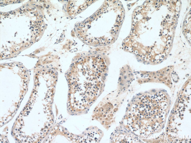 RGS14 Antibody in Immunohistochemistry (Paraffin) (IHC (P))