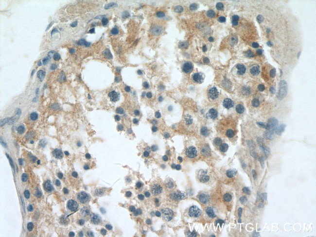 RGS14 Antibody in Immunohistochemistry (Paraffin) (IHC (P))