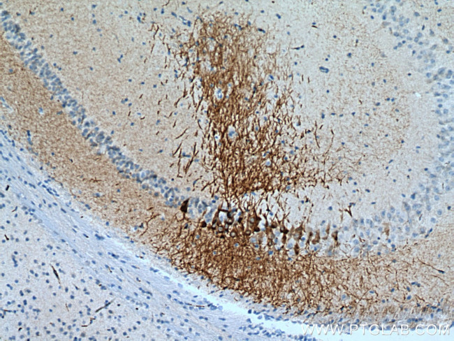 RGS14 Antibody in Immunohistochemistry (Paraffin) (IHC (P))