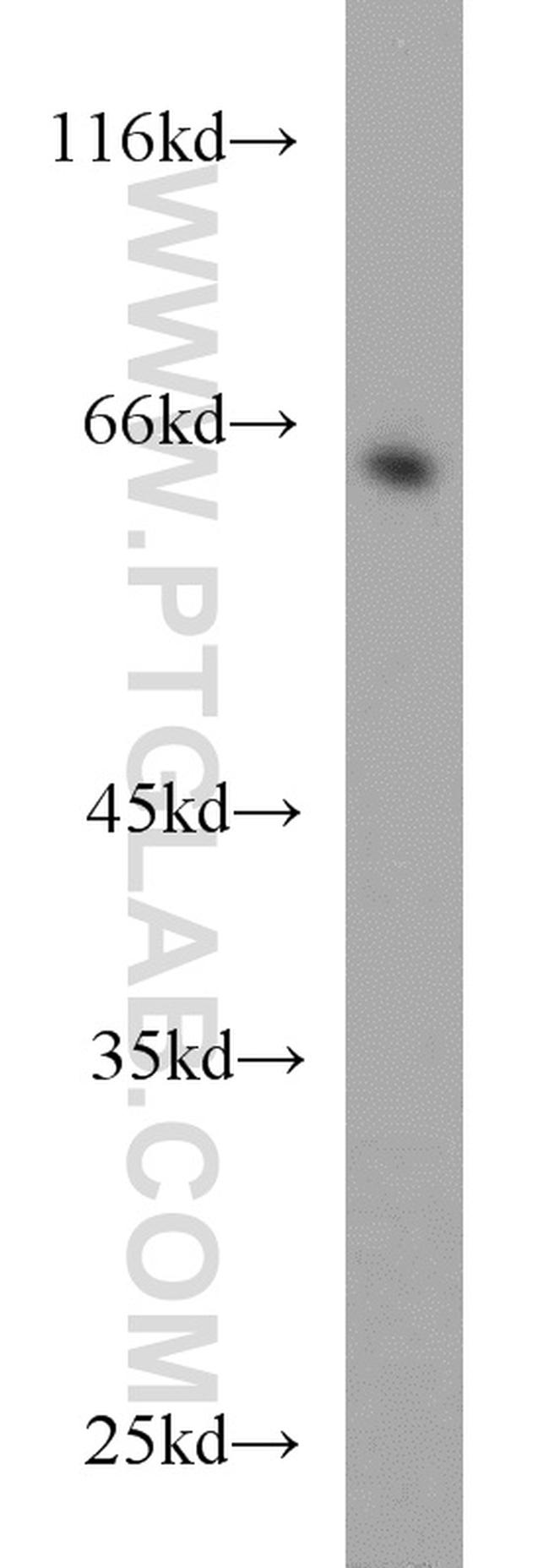 RGS14 Antibody in Western Blot (WB)