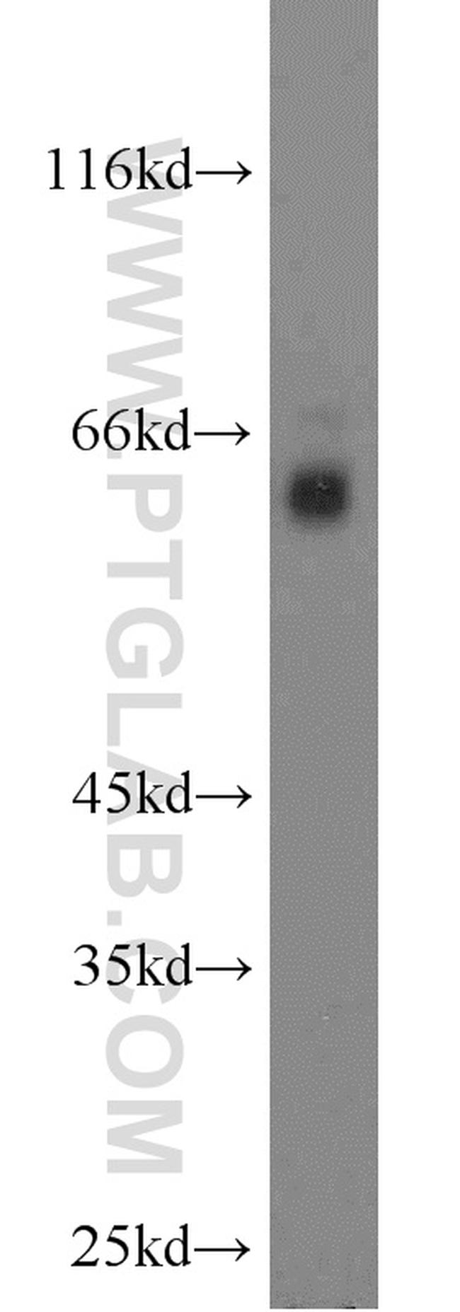 RGS14 Antibody in Western Blot (WB)