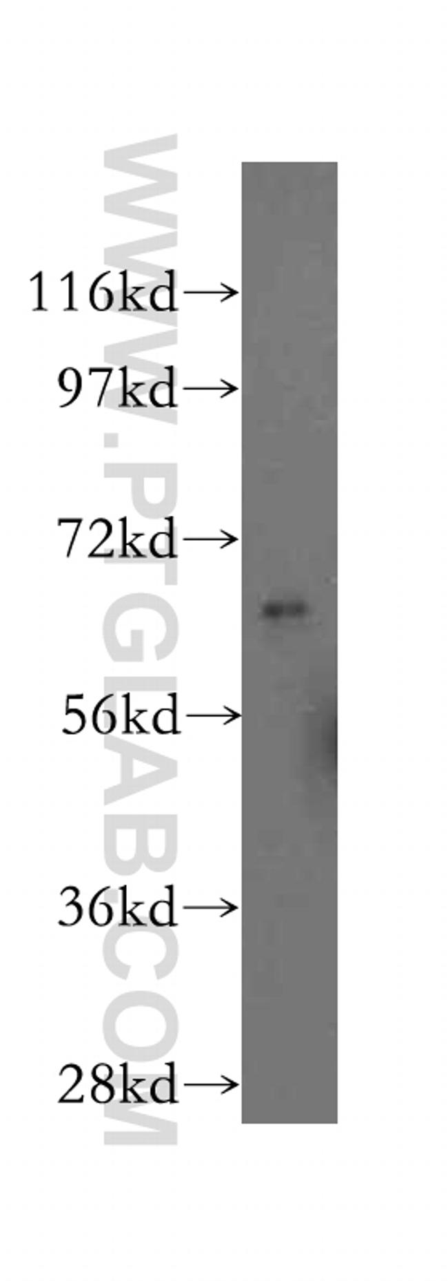 RGS14 Antibody in Western Blot (WB)