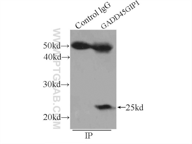 GADD45GIP1 Antibody in Immunoprecipitation (IP)