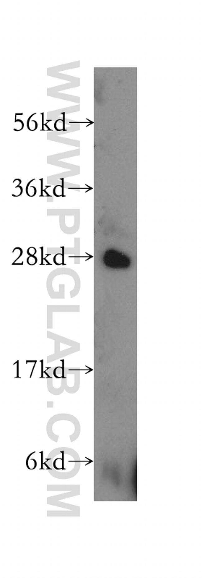 GADD45GIP1 Antibody in Western Blot (WB)