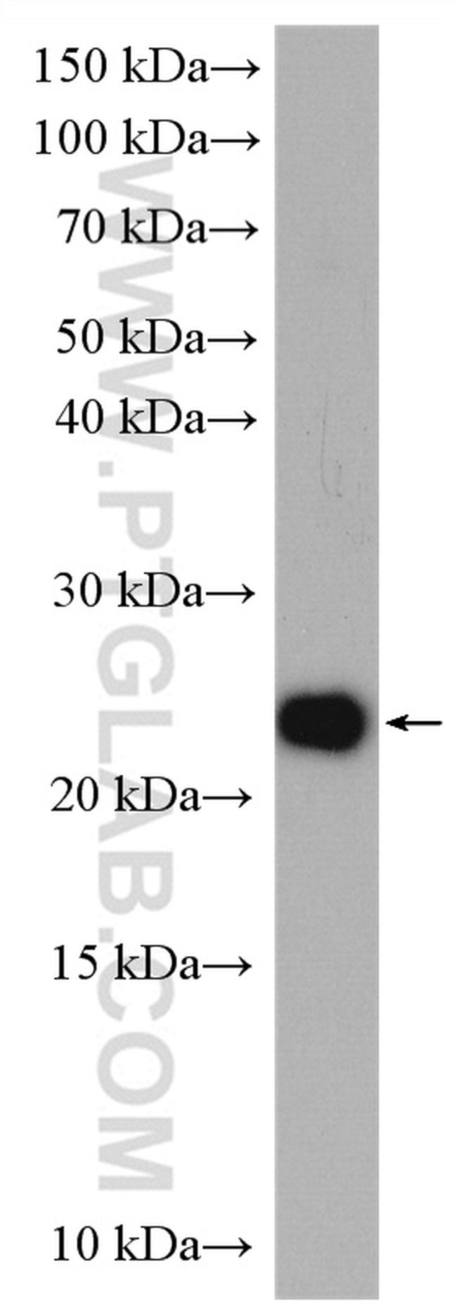 GADD45GIP1 Antibody in Western Blot (WB)