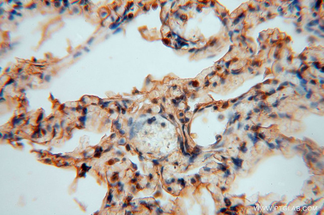 TSR2 Antibody in Immunohistochemistry (Paraffin) (IHC (P))