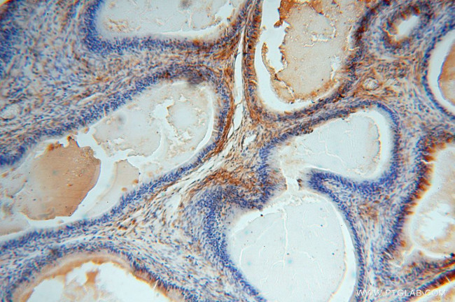 TSR2 Antibody in Immunohistochemistry (Paraffin) (IHC (P))