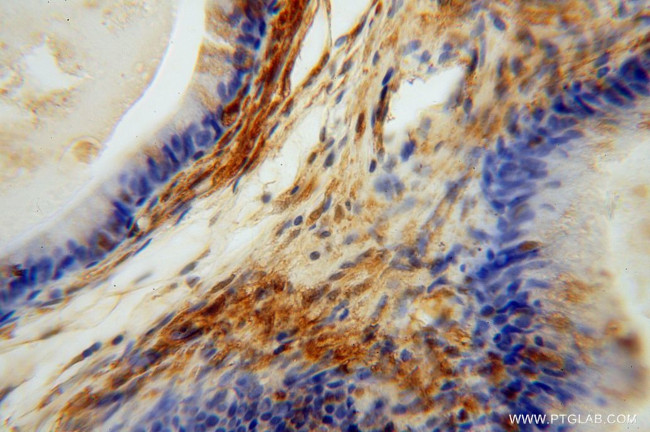 TSR2 Antibody in Immunohistochemistry (Paraffin) (IHC (P))