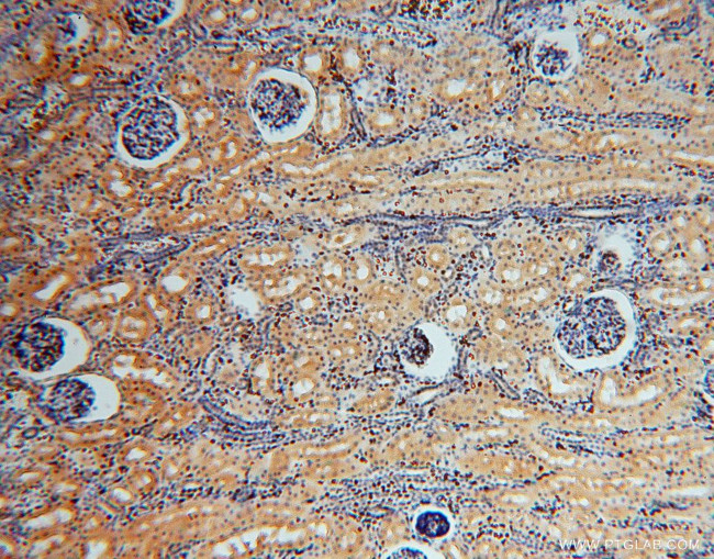 TSR2 Antibody in Immunohistochemistry (Paraffin) (IHC (P))