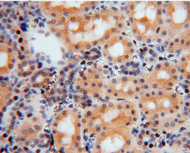 TSR2 Antibody in Immunohistochemistry (Paraffin) (IHC (P))