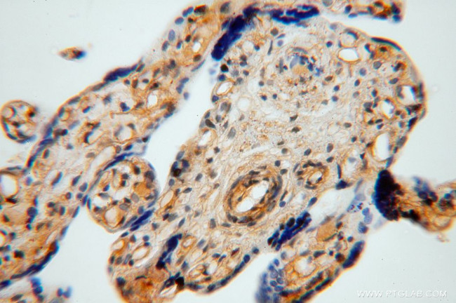 TSR2 Antibody in Immunohistochemistry (Paraffin) (IHC (P))