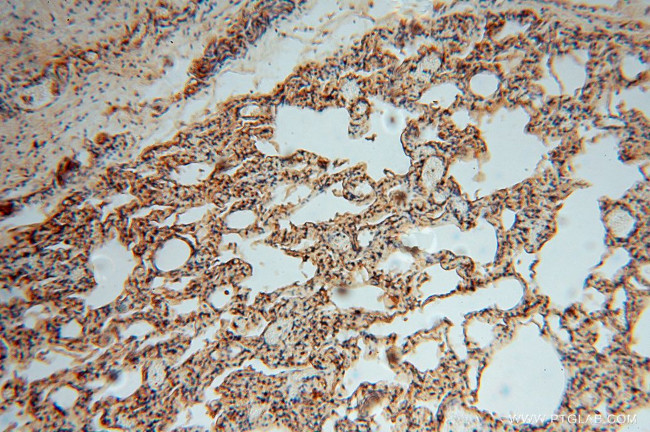 TSR2 Antibody in Immunohistochemistry (Paraffin) (IHC (P))