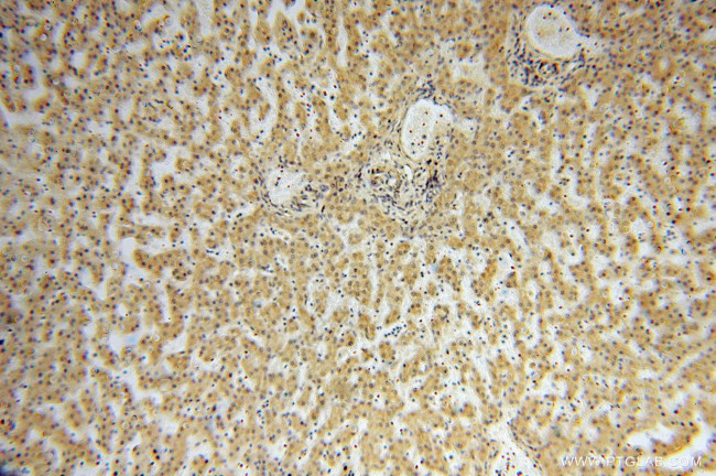 TSR2 Antibody in Immunohistochemistry (Paraffin) (IHC (P))