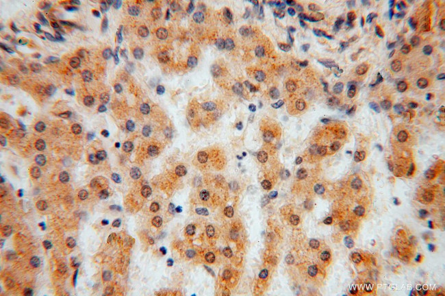 TSR2 Antibody in Immunohistochemistry (Paraffin) (IHC (P))