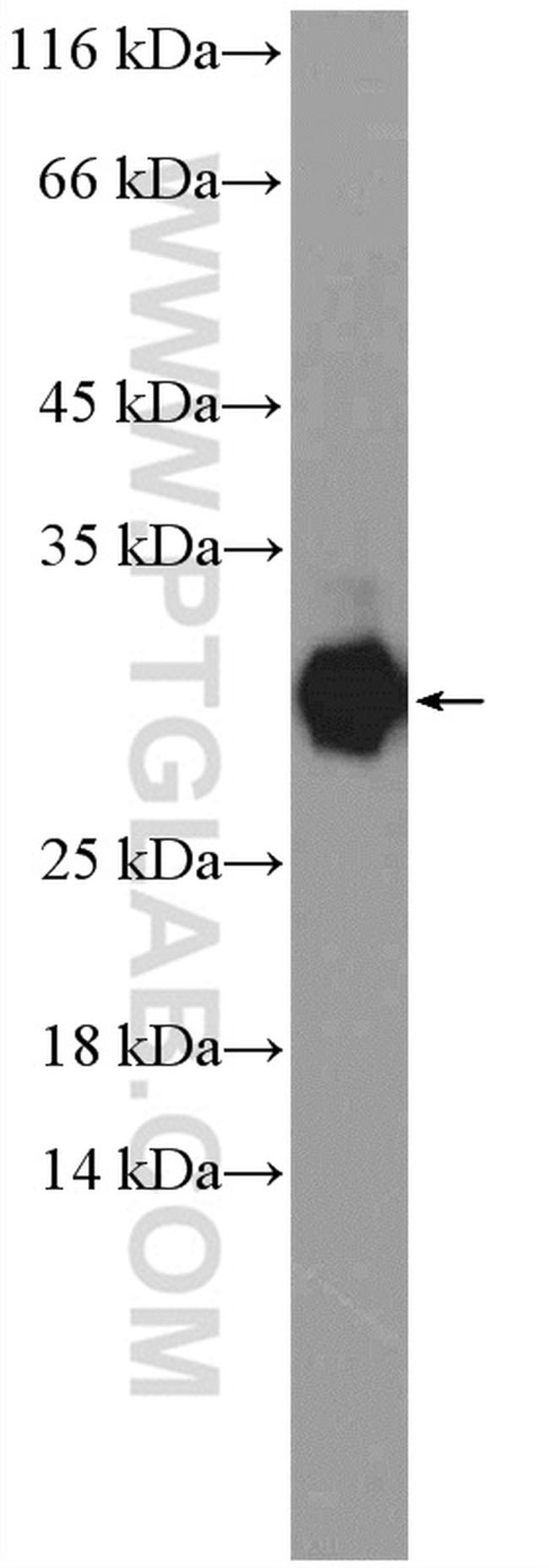 TSR2 Antibody in Western Blot (WB)