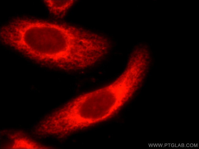 CEP63 Antibody in Immunocytochemistry (ICC/IF)