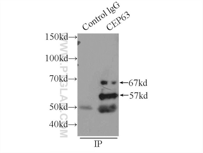 CEP63 Antibody in Immunoprecipitation (IP)