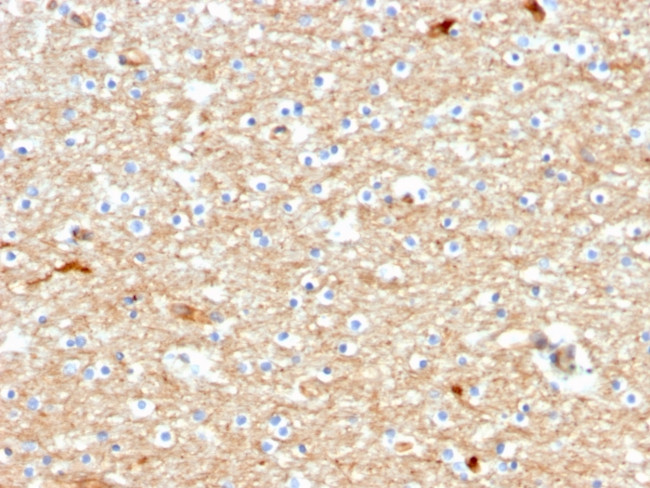 Drebrin 1 (DBN1) Antibody in Immunohistochemistry (Paraffin) (IHC (P))