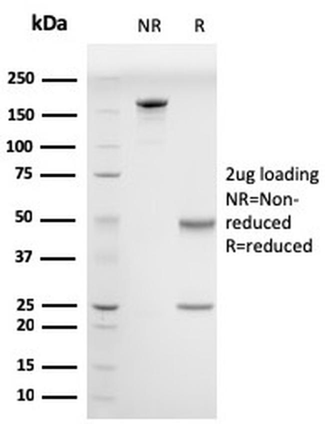 Drebrin 1 (DBN1) Antibody in SDS-PAGE (SDS-PAGE)