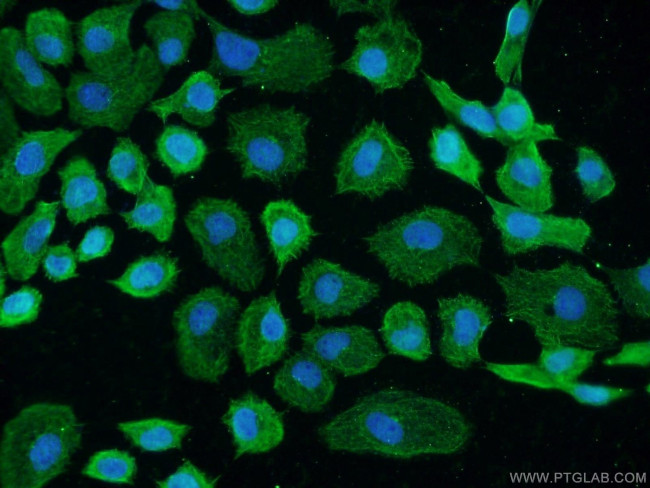 GCC1 Antibody in Immunocytochemistry (ICC/IF)