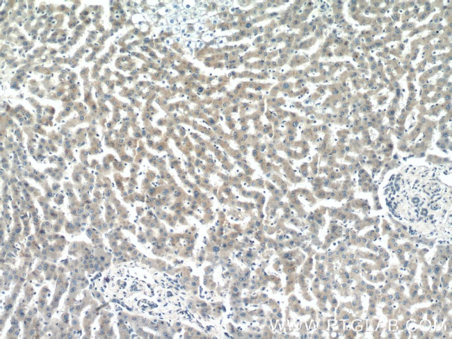 GCC1 Antibody in Immunohistochemistry (Paraffin) (IHC (P))