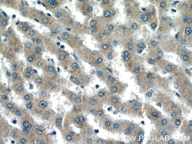 GCC1 Antibody in Immunohistochemistry (Paraffin) (IHC (P))