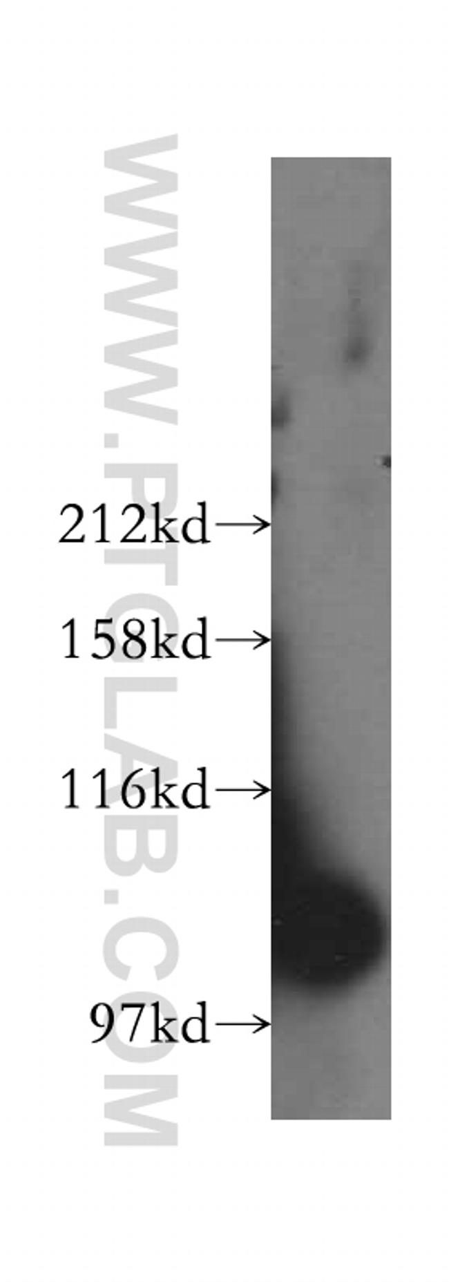 GCC1 Antibody in Western Blot (WB)